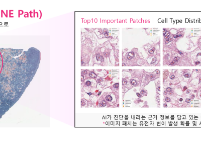 LG, 차세대 의료 AI '엑사원 패스' 공개